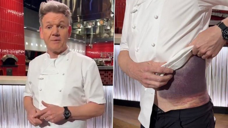 Gordon Ramsay Accident: On Father’s Day, Celebrity Chef Gives Message to All Dads to ‘Wear a Helmet’ Following Bike Injury, Shows His Bruised Torso via Video Post