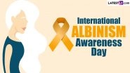 International Albinism Awareness Day 2024 Date & Theme: Know Significance About the Day That Raises Awareness on Albinism