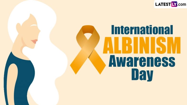 International Albinism Awareness Day 2024 Date &amp; Theme: Know Significance About the Day That Raises Awareness on Albinism
