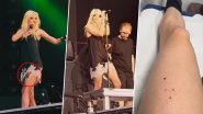 Taylor Momsen Bitten by Bat Onstage During Spain Concert, Requires Two Weeks of Rabies Shots (Watch Video)