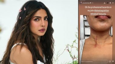 Priyanka Chopra Injured Filming Action Sequence for The Bluff; Actress Shares Pic of Wound