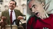 Is Rowan Atkinson Aka ‘Mr Bean’ Bed-Ridden After a Major Health Crisis? Here’s the Truth Behind the Viral ‘Death Bed’ Photo!