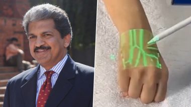 New Technology Detecting Veins Using Infrared Light Shared by Anand Mahindra