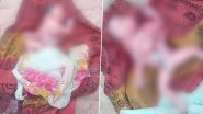 Miracle Baby in Uttar Pradesh: Child Born With 2 Heads, 4 Hands and 4 Legs in Sitapur, Under Medical Care (See Pics)