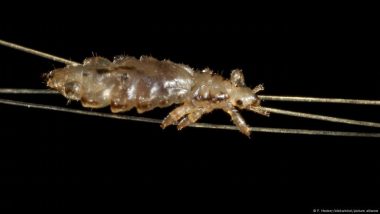 How to Get Rid of Head Lice