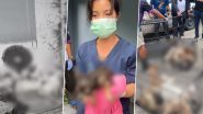 Thailand Horror: 28 Starving Dogs Survive for by Consuming Dead Owner’s Leg in Bangkok, Disturbing Video Surfaces