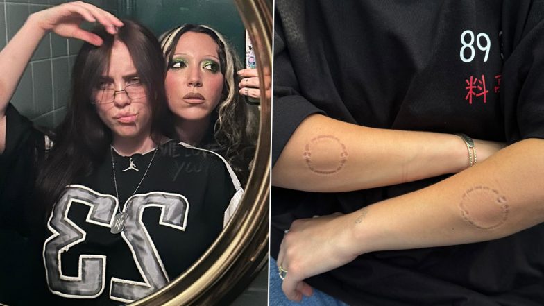 Billie Eilish’s Photo Dump Features Unexplained Bite Marks and Bruises on Her Body, Pictures Go Viral