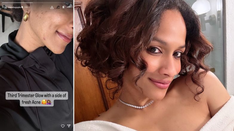 Pregnant Masaba Gupta Shows ‘Fresh Acne’ in New No Makeup Photo