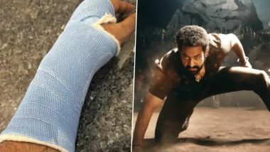 Jr NTR Suffers 'Minor' Wrist Injury; ‘Devara’ Makers Share Actor's Health Update Via Official Statement