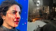 Did Priyanka Chopra Injure Herself on the Sets of &lsquo;The Bluff&rsquo;? Actress Drops Photos of Her &lsquo;Bloody Fun Times&rsquo;