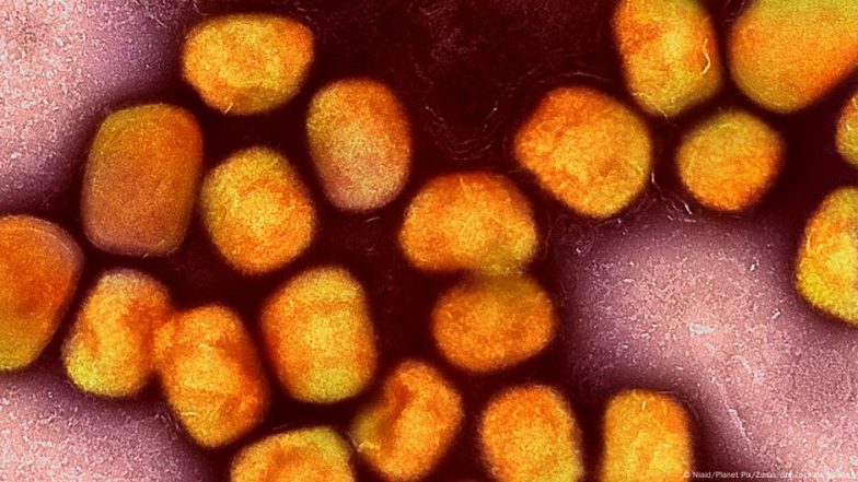 Fact Check: No Link Between Mpox and COVID Vaccination