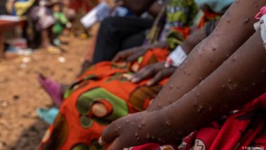 Congo 'working Blindly' in Attempts to Control Mpox Outbreak