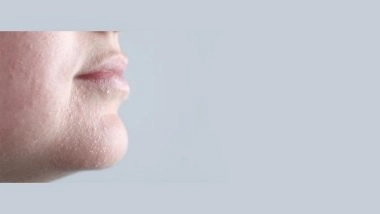 Business News | How to Choose the Right Face Wash for Sensitive or Dry Skin?