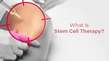 Business News | What Is Stem Cell Therapy? How Does It Work?