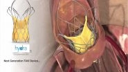 Business News | SMT Won the Italian National CONSIP 2-Year Tender to Supply Hydra TAVI in All Italian Hospitals