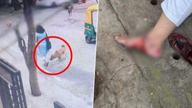 Dog Attack in Bengaluru: Woman Attacked by Stray Dog in OMBR Layout, Saved by Locals (Watch Video)