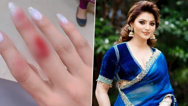 Urvashi Rautela Faces Backlash for Hospitalisation Over Finger Injury; Netizens Says ‘First Woman to Get Hurt’ (Watch Video)