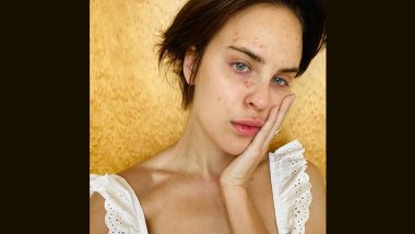 Tallulah Willis Reveals Personal Struggles with Skin-Picking Disorder in Emotional Post