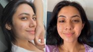 ‘I’ve Healed’: Reem Sameer Shaikh Shares Health Update Following Facial Burn Injury on ‘Laughter Chefs Unlimited Entertainment’ Sets (See Pics)