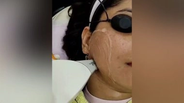 Business News | Sculpt Clinics Revolutionizes Laser Hair Removal with New Technology Reducing Treatment Time by Half