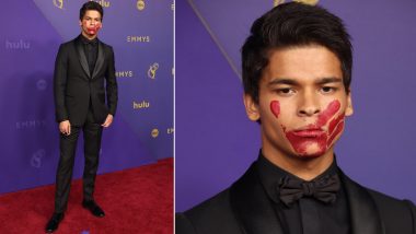 Emmys 2024: ‘Reservation Dogs’ Actor D’Pharaoh Woon-A-Tai Makes Bold Statement With Red Handprint Over His Mouth in Support of Missing and Murdered Indigenous Women (View Pics)