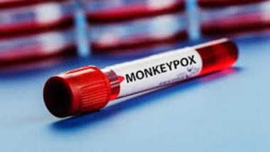 Mpox Jaipur: Suspected Case of Monkeypox Reported at Sanganer Airport, Patient Sent to RUHSH