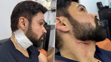 ‘Goodachari 2’: Emraan Hashmi Sustains Deep Cut in Neck During Filming of Action Scene in Hyderabad! (See Pic)