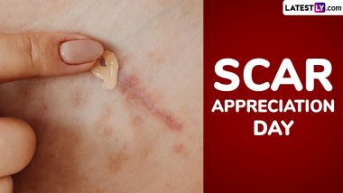 National Scar Appreciation Day 2024 Date and Significance: Everything To Know About the Day That Focusses on Appreciating and Showing Love Towards Scars