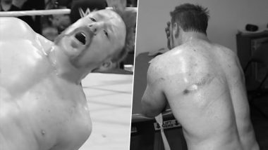 Sheamus Gets Bruised, Defeats Pete Dunne in 'Good Ol' Fashioned Donnybrook Match' During WWE Raw After Bad Blood 2024; Videos Go Viral