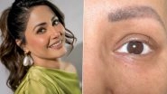 Hina Khan Shares Emotional Update on Chemotherapy Journey; Says &lsquo;This Single Eyelash Is My Motivation&rsquo; (View Pics)