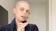 Bella Bradford Dies at 24; Australian TikTok Star Announces Own Death in Pre-Recorded Video After Battle With Rhabdomyosarcoma 