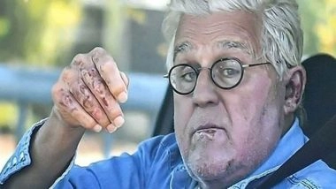 Entertainment News | Jay Leno Suffers Eye Injury After Falling Down a Hill