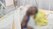 Bihar Shocker: Dead Man’s Eye Goes Missing At Nalanda Medical College and Hospital in Patna, Doctors Blame Rats (Watch Video)