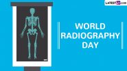 World Radiography Day 2024 Date, Theme, History and Significance: All You Need to Know About the Day That Highlights the Importance of Radiography in Healthcare