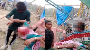 Kannauj Horror: Teenage Girl’s Hair Gets Entangled in Swing’s Rod at Fair, Entire Scalp Ripped Off; Disturbing Video Surfaces