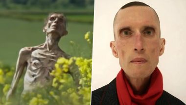 ‘28 Years Later’ Zombie NOT Cillian Murphy? Know About the Real Actor Behind the Role