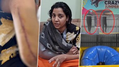 Udaipur Trampoline Park Freak Accident: Influish Co-Founder Shivani Rajora Left With Fractured Hand During Fun Activity, Shares Video Message Alleging Safety Lapses