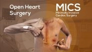 Business News | Transforming Heart Care: A Traveler's Guide to Minimally Invasive Cardiac Surgery