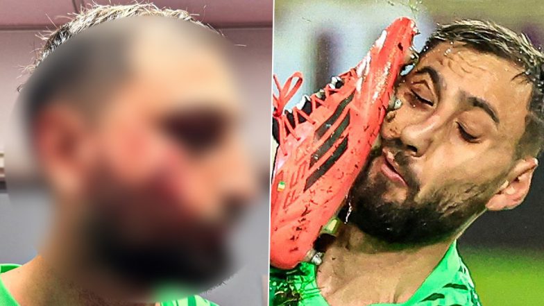 Gianluigi Donnarumma Suffers Facial Injuries Following Wilfried Singo Foul During Monaco vs PSG Ligue 1 2024–25 Clash, Video and Pics Go Viral
