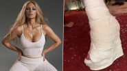 Kim Kardashian Shows Off Her Wild High-Heeled Cast, Reality TV Star Turns Injury Into Fashion Statement in Latest Picture