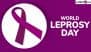 World Leprosy Day 2025 Date and Theme: Know History and Significance of the Day That Raises Awareness About Hansen’s Disease