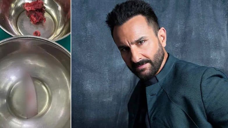 Saif Ali Khan Stabbing Case: Photo of 2.5-Inch Knife Portion Removed From Actor’s Spine During Surgery Circulates Online