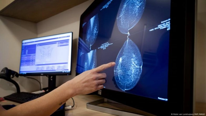 New AI Method Improves Early Breast Cancer Detection