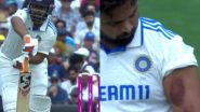 Rishabh Pant Suffers Bruise On His Hand After Being Hit by Mitchell Starc's Fiery Delivery During IND vs AUS 5th Test 2025 (Watch Video)