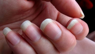 Why Do Some People's Hair, Nails Grow Quicker Than Mine? Here Are Some Reasons