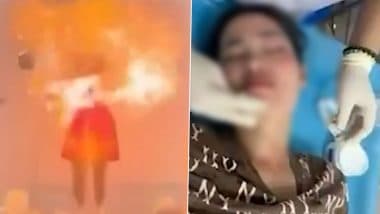 Hydrogen Balloon Explosion Video: Balloons Explode on Woman’s Face During Birthday Celebration in Vietnam, Are They Safe?