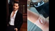 Varun Dhawan Suffers Injury: ‘Border 2’ Actor Takes to Social Media To Inform Fans About Deep Cut on His Finger (See Pic)