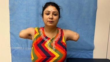 India News | Hand of Hope: 38-year-old's Life Transformed After Receiving Donor Hands at Private Hospital in Faridabad