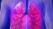 World News | Pakistan: Karachi Faces Alarming Rise in Respiratory Diseases