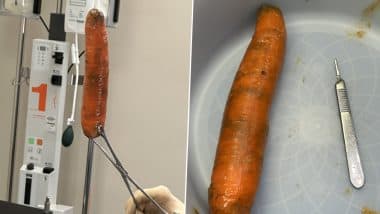 ‘Stop Putting Foreign Objects Down Your An**es!’ Doctor Issues Stern Warning After Removing a Carrot From Man’s A-Hole, X Post Goes Viral